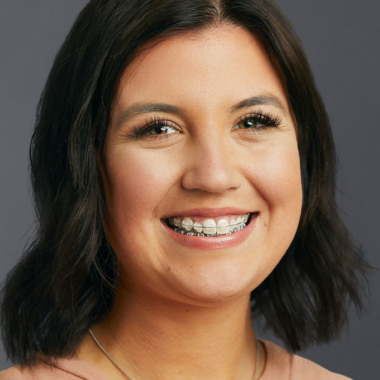 woman smiling wearing clear ceramic braces at dovorany orthodontics