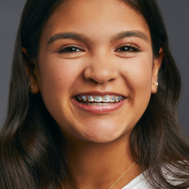 young woman wearing metal braces and smiling at dovorany orthodontics