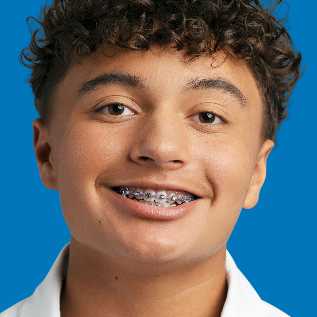 young boy smiling wearing metal braces with purple bands at dovorany orthodontics