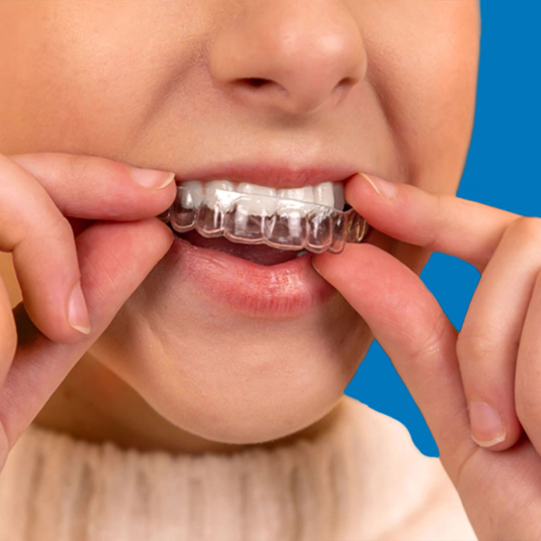 clear orthodontic retainers at dovorany orthodontics